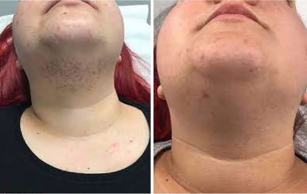 <h2><strong>Ne vous contentez pas de nous croire, voyez ce que les autres en disent!</strong></h2>