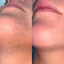 <h2><strong>Ne vous contentez pas de nous croire, voyez ce que les autres en disent!</strong></h2>