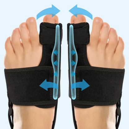 CorrecteOrteil™ | Soulagement Durable et Sans Médicament de l'Hallux Valgus. 🚶‍♀️✨
