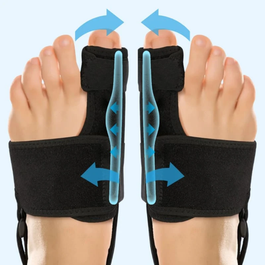 CorrecteOrteil™ | Soulagement Durable et Sans Médicament de l'Hallux Valgus. 🚶‍♀️✨