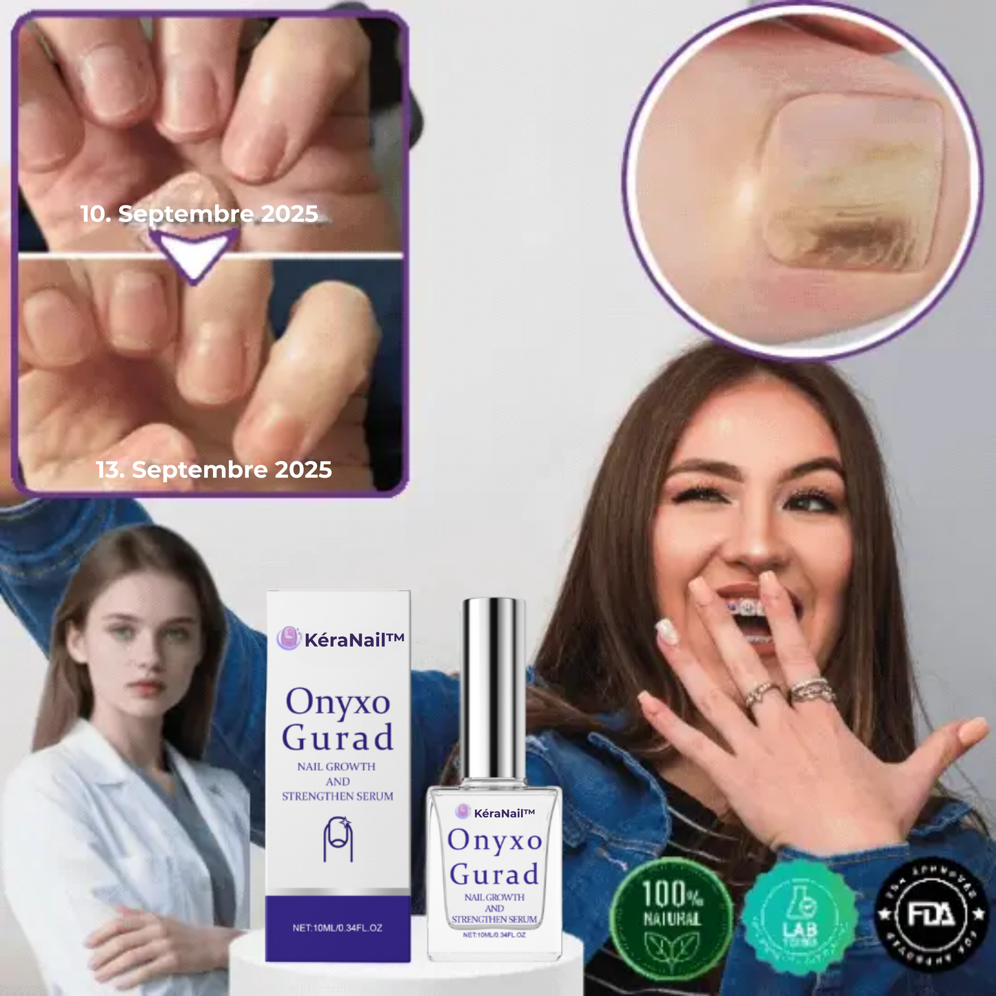 KéraNail™ | Réparez, Renouvelez et Retrouvez votre Confiance. 💪