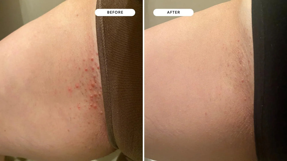 <h2><strong>Ne vous contentez pas de nous croire, voyez ce que les autres en disent!</strong></h2>