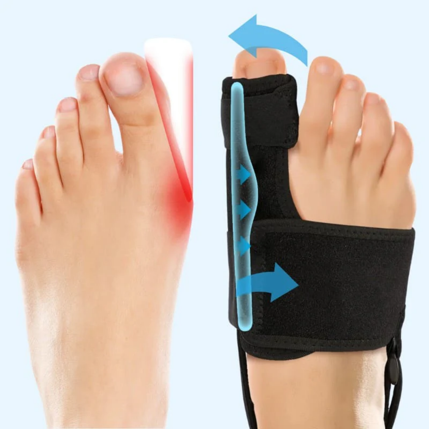 CorrecteOrteil™ | Soulagement Durable et Sans Médicament de l'Hallux Valgus. 🚶‍♀️✨