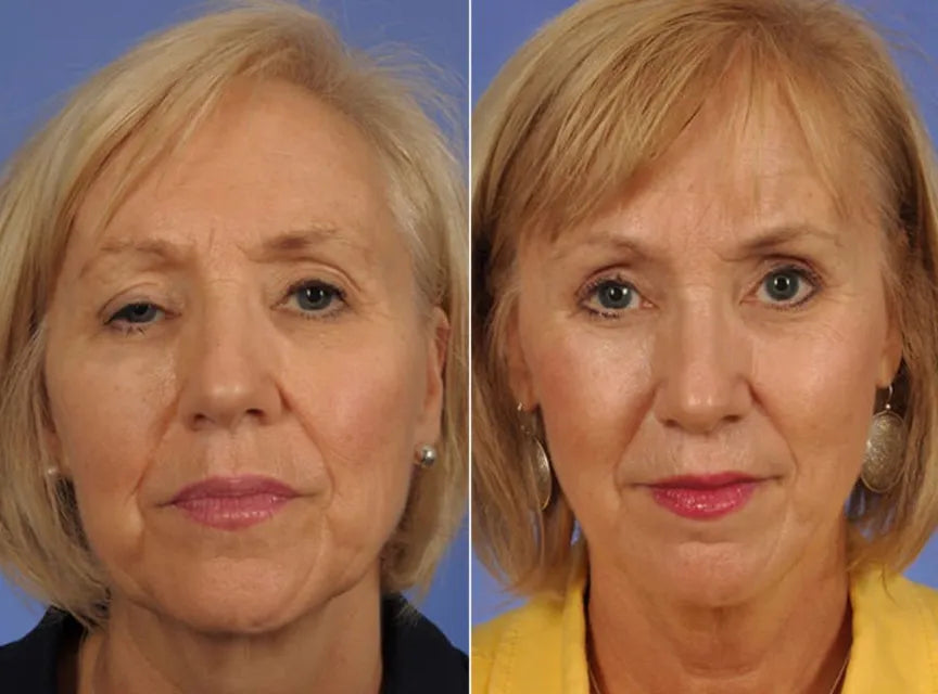 <h2><strong>Ne vous contentez pas de nous croire, voyez ce que les autres en disent!</strong></h2>