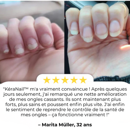 KéraNail™ | Réparez, Renouvelez et Retrouvez votre Confiance. 💪