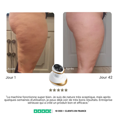 ThermoCelluWave™ | Dites Adieu à la Peau d'Orange