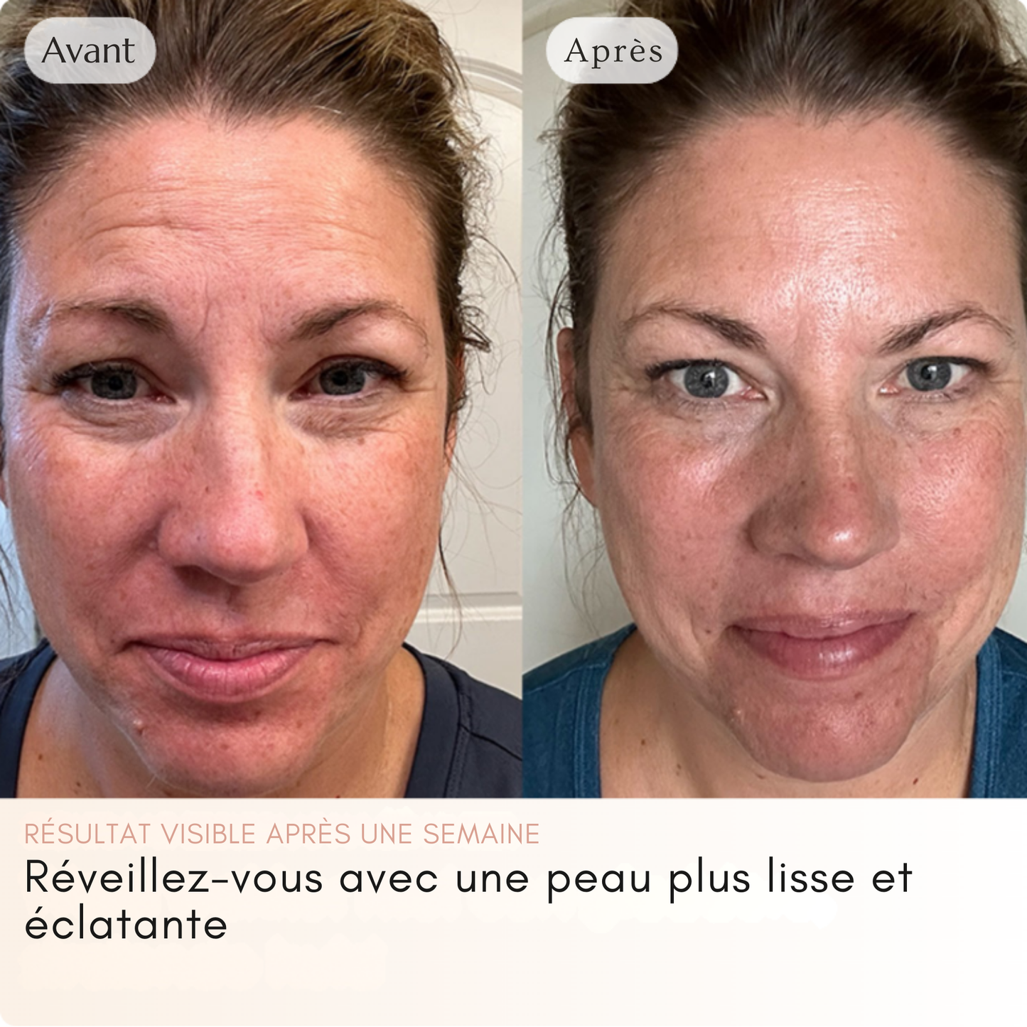 Glowskin™ | Masque au collagène