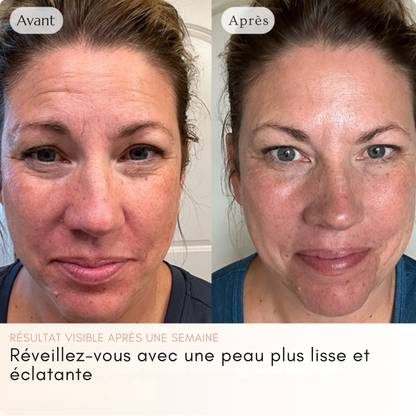 Glowskin™ | Masque au collagène