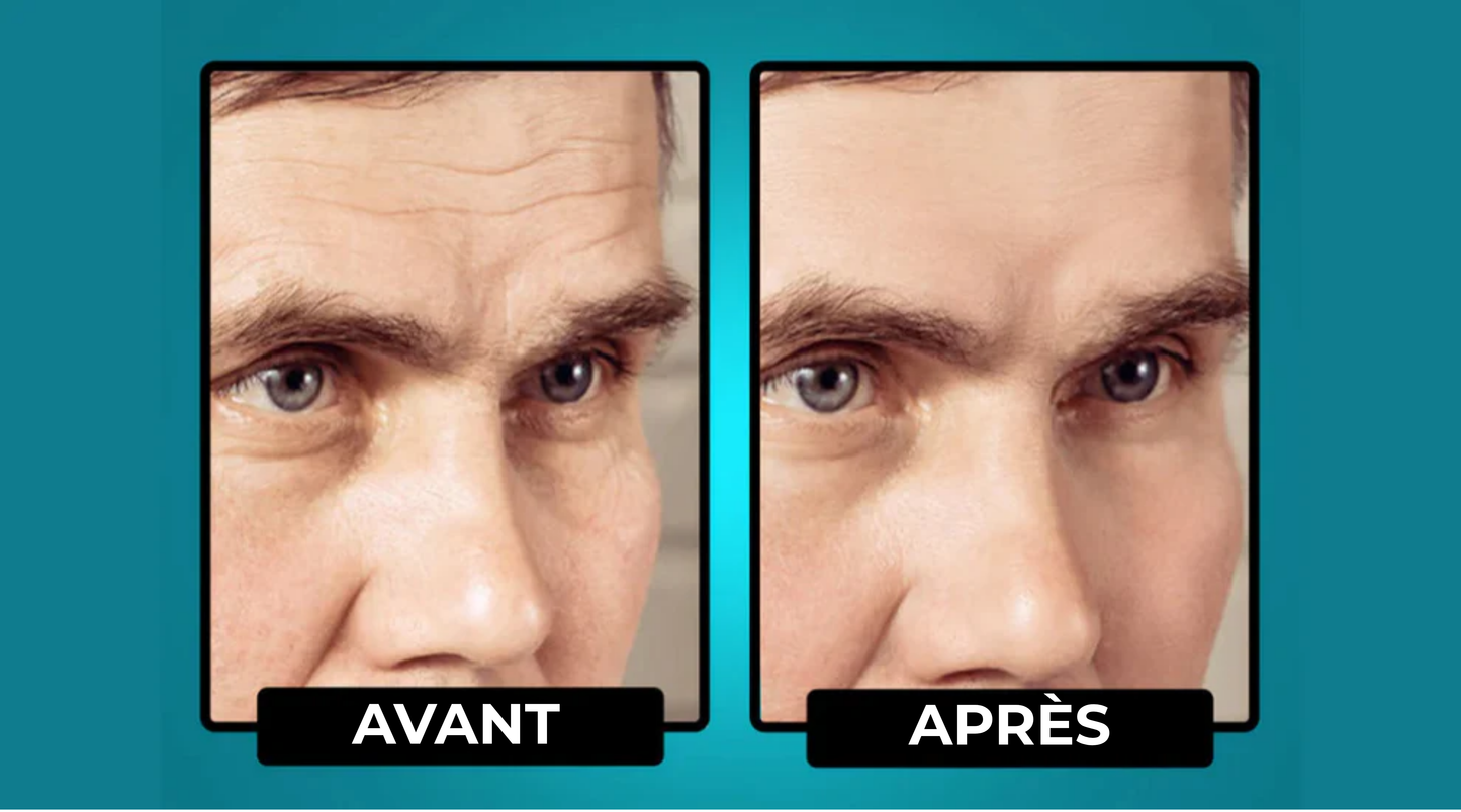 LisseÂge™ | Une Peau Visiblement Plus Ferme en 20 Secondes Par Jour. ✨🕰️