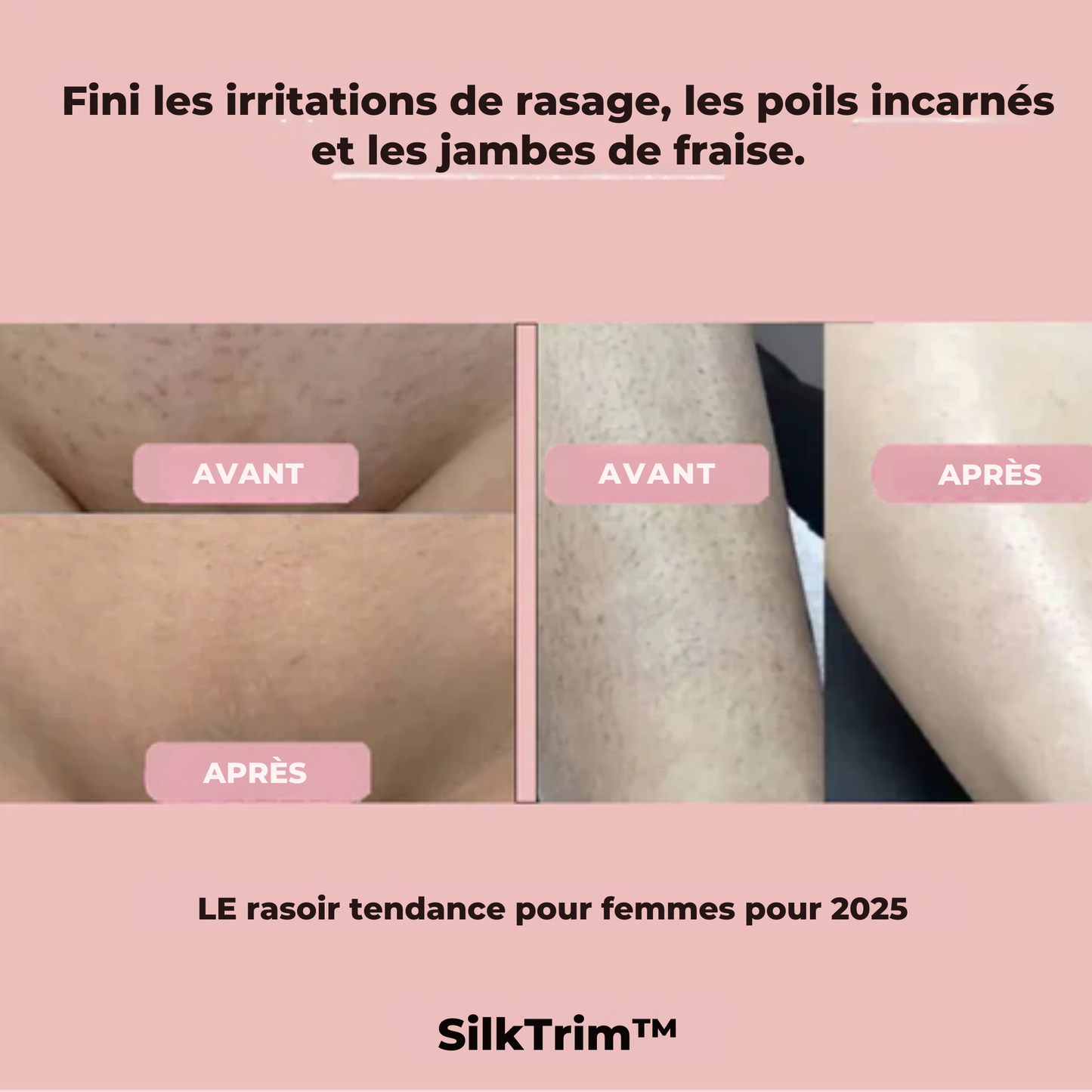 SilkTrim™ | Le Nouveau Meilleur Ami des Peaux Sensibles