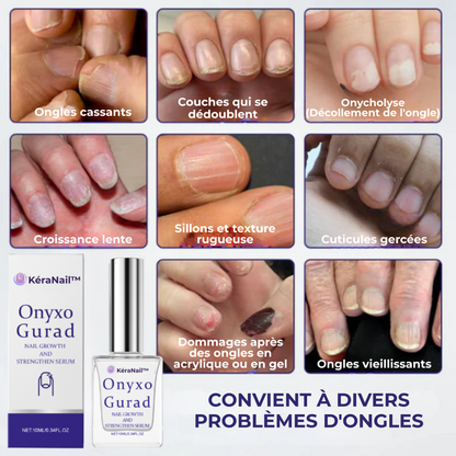 KéraNail™ | Réparez, Renouvelez et Retrouvez votre Confiance. 💪