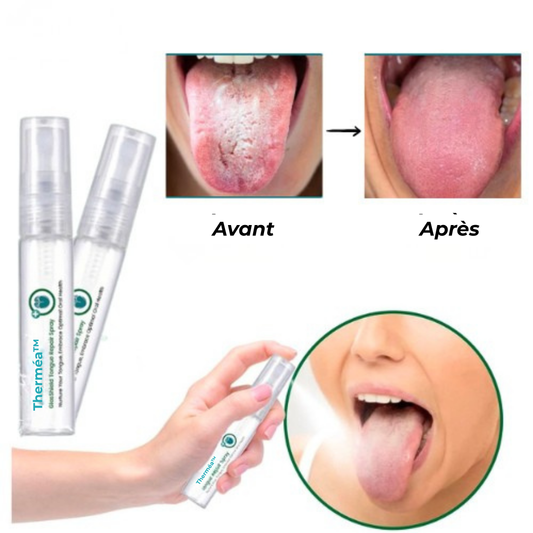 Therméa™ | La solution 48h pour une langue rose, sans douleur et fraîche
