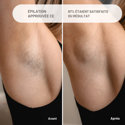Lumière Épilation™ | Douceur Permanente. Procédé Indolore. Zéro Regret.