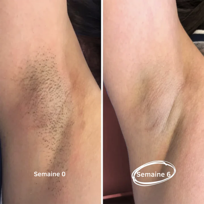 Lumière Épilation™ | Douceur Permanente. Procédé Indolore. Zéro Regret.