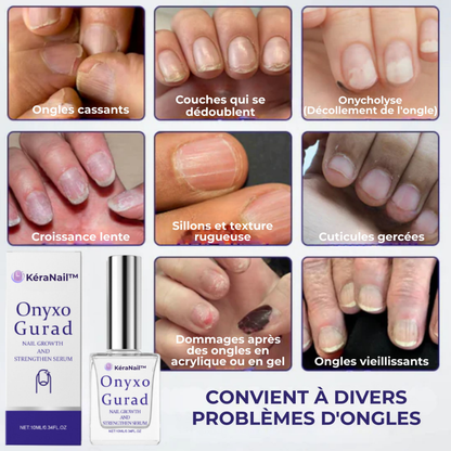 KéraNail™ | Réparez, Renouvelez et Retrouvez votre Confiance. 💪