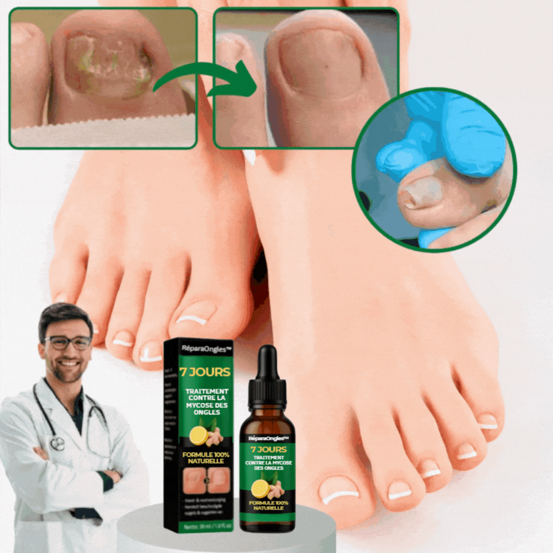 RéparaOngles™ | Débarrassez-vous des mycoses des ongles tenaces en seulement 7 jours !