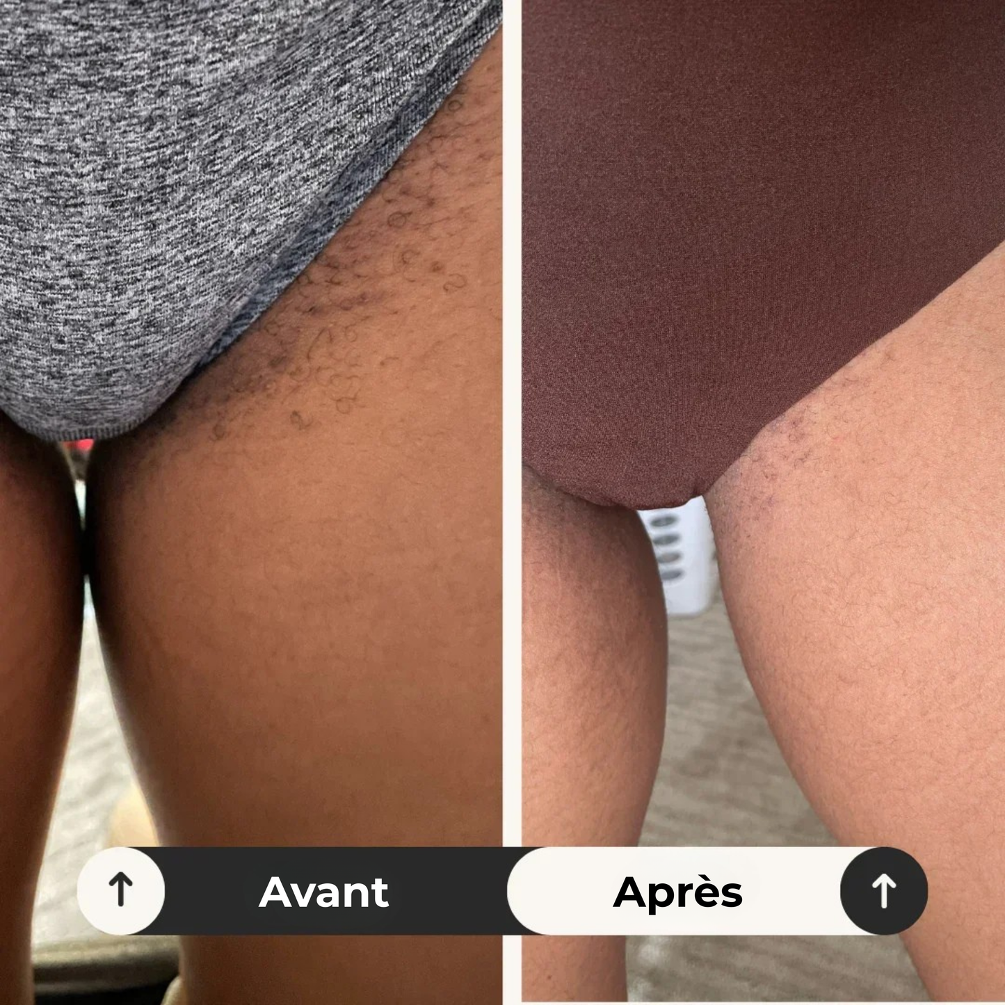 intimRelief™ | Soulagement en 72 Heures : Retrouvez Confort et Confiance Naturellement.