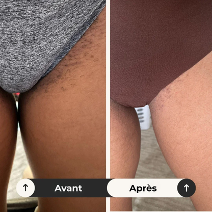 intimRelief™ | Soulagement en 72 Heures : Retrouvez Confort et Confiance Naturellement.